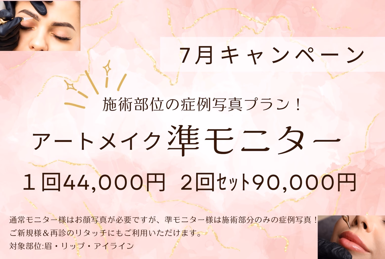 アートメイク準モニターcp