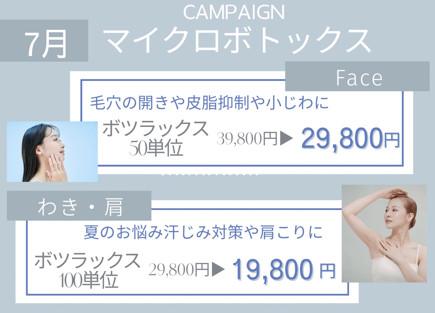 ボトックスキャンペーン